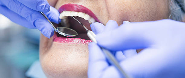 Best Emergency Dental Surgery in Boulevard Park, WA